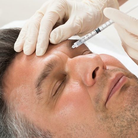 men-dermal-fillers-recovery